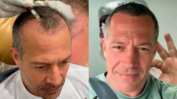 Seguidores reagiram ao "antes e depois" dos cabelos de Malvino Salvador (Reprodução)