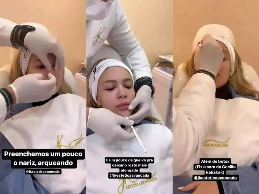 Karoline Lima mostrando os procedimentos. (Imagem: Reprodução/Instagram)