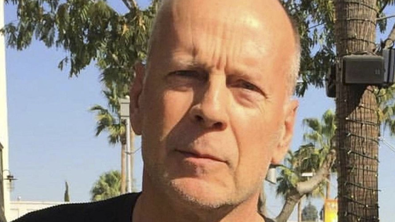 O ator Bruce Willis sofre de uma doença neurológica incurável
