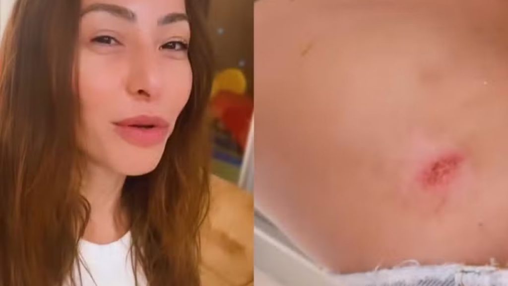 Sabrina Sato vem sentindo os efeitos do Carnaval